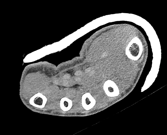 Normal wrist CT (Radiopaedia 41425-44297 Axial non-contrast 16).png