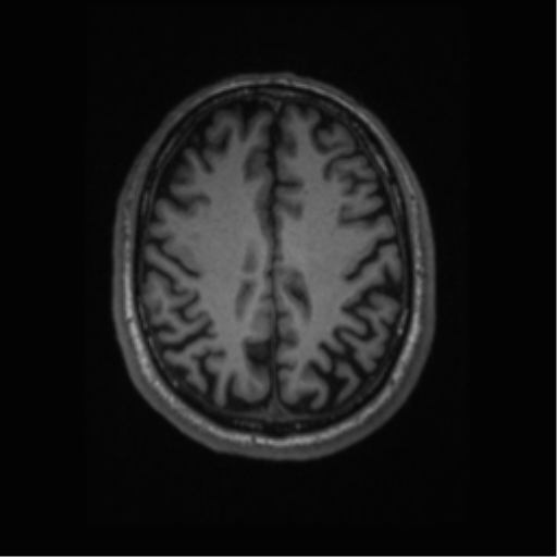 File:Alzheimer disease - probable (Radiopaedia 35334-36837 Axial T1 53).png