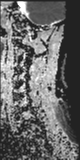 File:Normal MRI cervical spine (infection protocol) (Radiopaedia 53916-60039 Sagittal 2).png