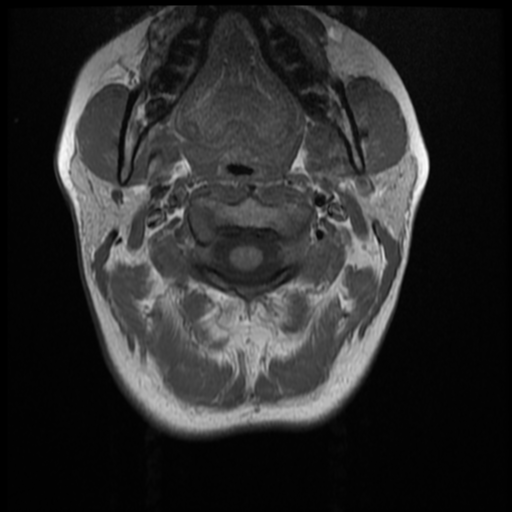 File:Normal cervical and thoracic spine MRI (Radiopaedia 35630-37156 Axial T1 29).png