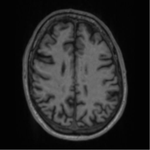 File:Alzheimer's disease- with apraxia (Radiopaedia 54763-61011 Axial T1 51).png