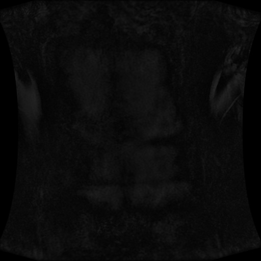Normal MRI abdomen in pregnancy (Radiopaedia 88001-104541 N 2).jpg