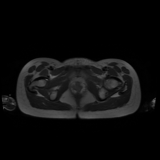 File:Normal MRI abdomen in pregnancy (Radiopaedia 88001-104541 Axial T2 71).jpg