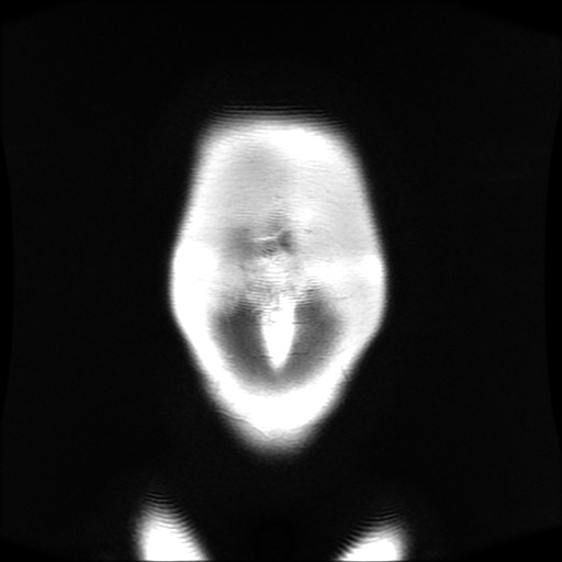 File:Normal MRI abdomen in pregnancy (Radiopaedia 88001-104541 Coronal T2 4).jpg