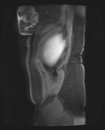 File:Normal hepatobiliary phase liver MRI (Radiopaedia 58968-66230 C 5).jpg