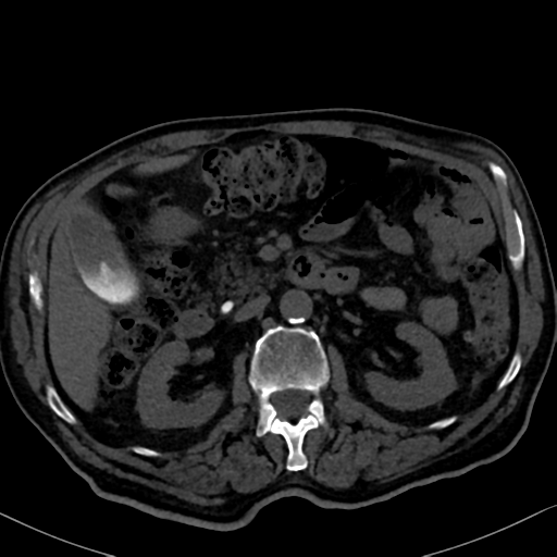 File:Normal CT intravenous cholangiogram (Radiopaedia 38199-40208 Axial IVC 46).png