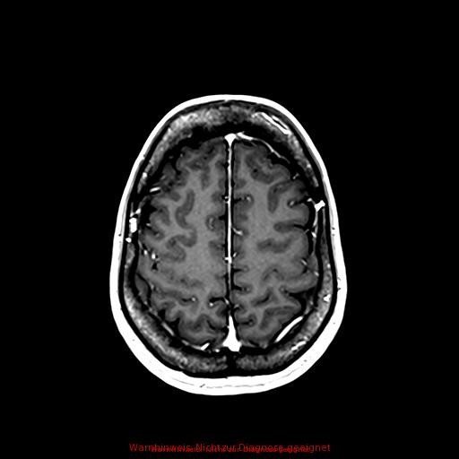 Normal adult brain MRI (non-enhanced and contrast-enhanced) (Radiopaedia 75262-86379 Axial T1 C+ 146).jpg