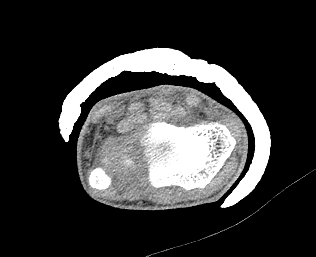 Normal wrist CT (Radiopaedia 41425-44297 Axial non-contrast 36).png