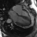File:Cardiac MRI- standard imaging planes (Radiopaedia 14225-14090 B 12).jpg