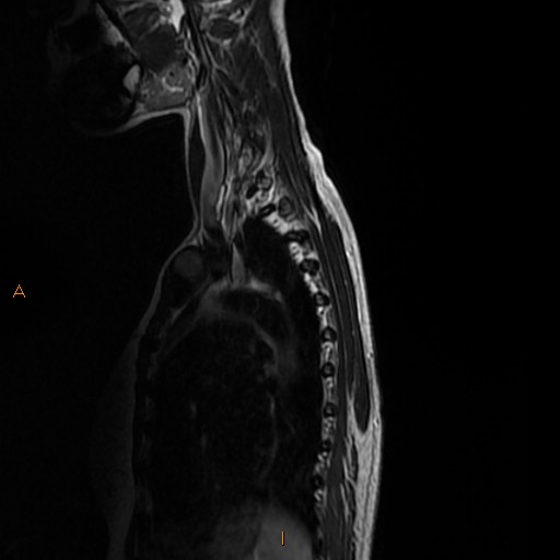 File:Normal spine MRI (Radiopaedia 77323-89408 E 14).jpg