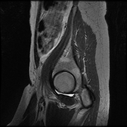 File:Normal female pelvis MRI (retroverted uterus) (Radiopaedia 61832-69933 Sagittal T2 1).jpg