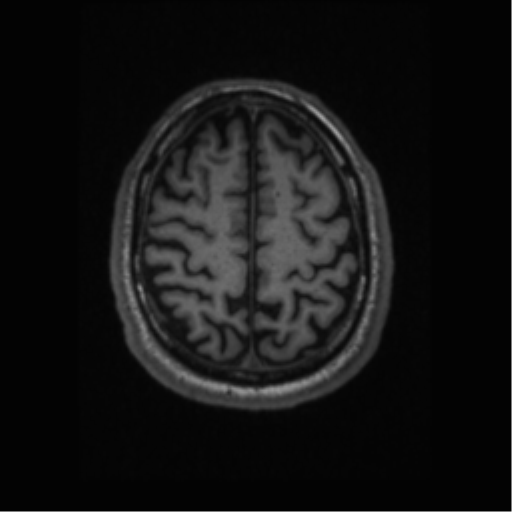 Alzheimer disease - probable (Radiopaedia 35334-36837 Axial T1 59).png