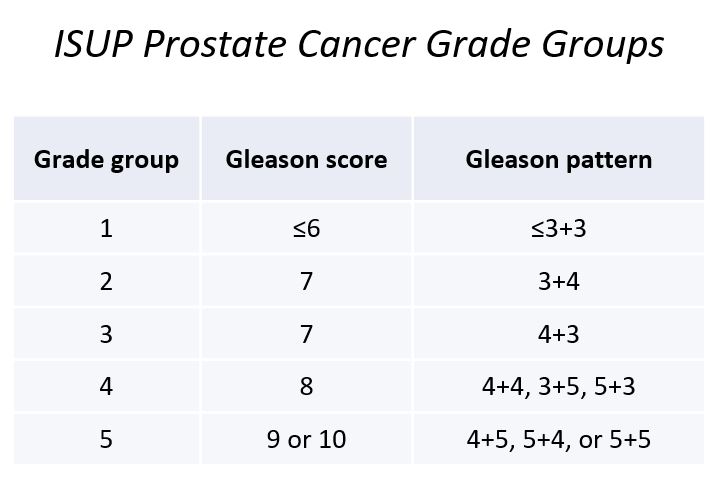 File:ISUP prostate cancer grade groups (table) (Radiopaedia 65285).JPG
