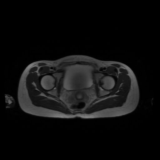 File:Normal MRI abdomen in pregnancy (Radiopaedia 88001-104541 Axial T2 66).jpg