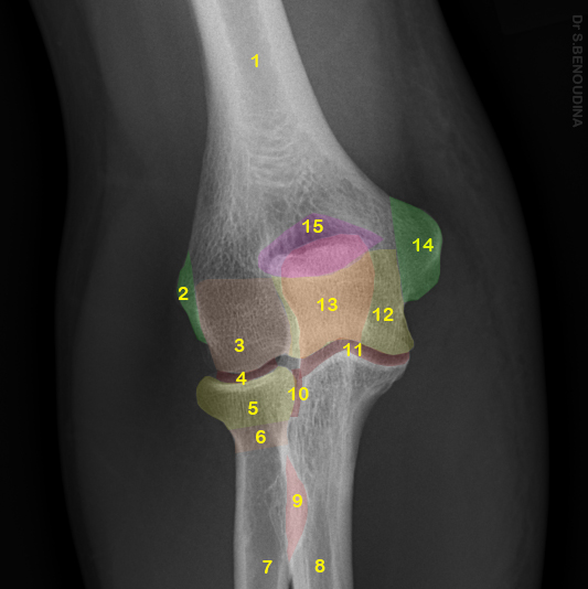 File:Normal radiographic anatomy of the elbow (Radiopaedia 48021-52819 Frontal 1).jpg
