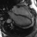 File:Cardiac MRI- standard imaging planes (Radiopaedia 14225-14090 B 26).jpg