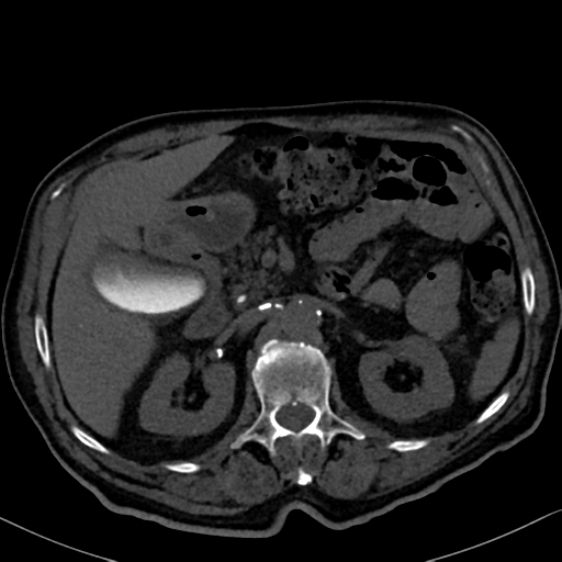 File:Normal CT intravenous cholangiogram (Radiopaedia 38199-40208 Axial IVC 40).png