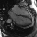 File:Cardiac MRI- standard imaging planes (Radiopaedia 14225-14090 B 22).jpg