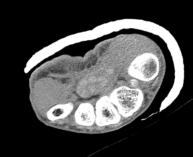 Normal wrist CT (Radiopaedia 41425-44297 Axial non-contrast 21).png