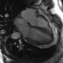 File:Cardiac MRI- standard imaging planes (Radiopaedia 14225-14090 B 9).jpg