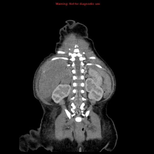 File:Neonatal neuroblastoma (Radiopaedia 9564-10223 B 99).jpg