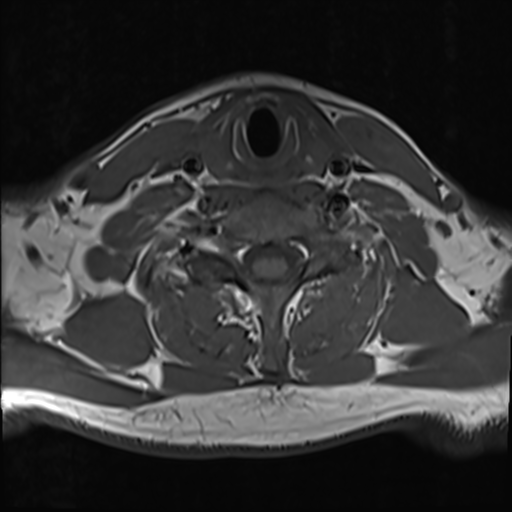 File:Normal MRI cervical spine (infection protocol) (Radiopaedia 53916-60039 Axial 37).png