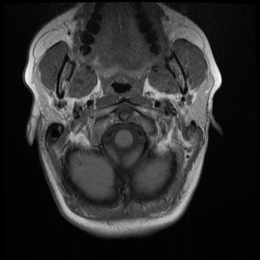File:Normal cervical and thoracic spine MRI (Radiopaedia 35630-37156 Axial T1 32).png