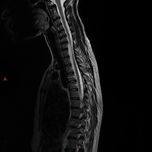 File:Normal spine MRI (Radiopaedia 77323-89408 E 7).jpg