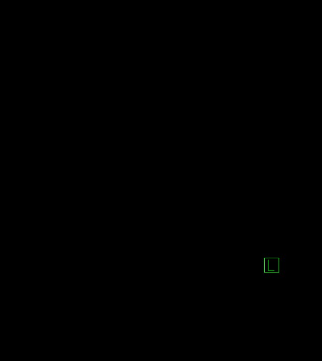 Anaplastic oligodendroglioma (Radiopaedia 79571-92753 C 56).jpg