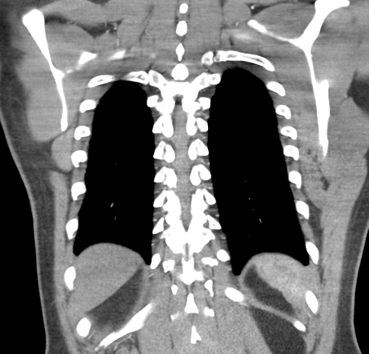 File:Normal CTA thorax (non ECG gated) (Radiopaedia 41750-44704 B 70).png