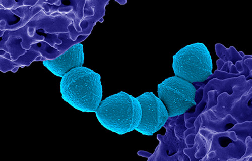 Colorized scanning electron micrograph of Group A Streptococcus (Streptococcus pyogenes) bacteria blue and a human neutrophil
