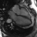 File:Cardiac MRI- standard imaging planes (Radiopaedia 14225-14090 B 5).jpg