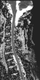 File:Normal MRI cervical spine (infection protocol) (Radiopaedia 53916-60039 Sagittal 7).png