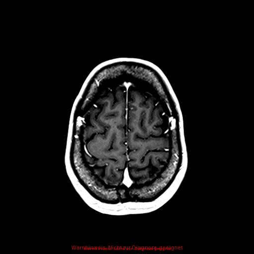 Normal adult brain MRI (non-enhanced and contrast-enhanced) (Radiopaedia 75262-86379 Axial T1 C+ 154).jpg