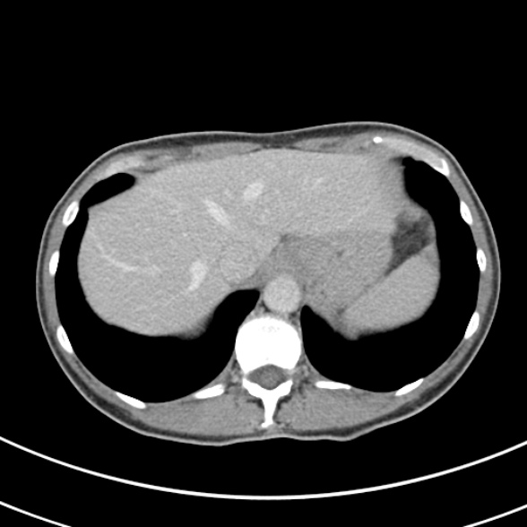 File:Normal multiphase CT liver (Radiopaedia 38026-39996 C 10).jpg