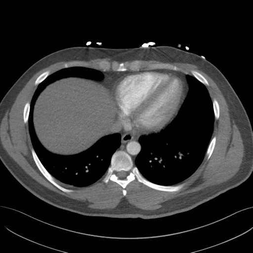 File:Normal CTA thorax (non ECG gated) (Radiopaedia 41750-44704 A 70).png