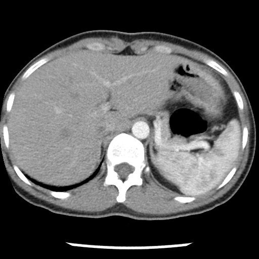 File:Non-small cell lung cancer with miliary metastases (Radiopaedia 23995-24193 A 37).jpg