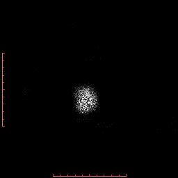 Choroid plexus xanthogranuloma (Radiopaedia 67843-77270 Axial T1 5).jpg