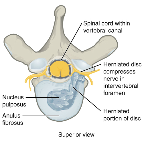File:Bones and ligaments of the vertebral column (illustrations) (Radiopaedia 42770-45935 Q 1).jpg