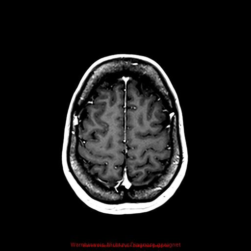 Normal adult brain MRI (non-enhanced and contrast-enhanced) (Radiopaedia 75262-86379 Axial T1 C+ 150).jpg