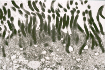 Human intestinal spirochetosis in transmission electron microscopy