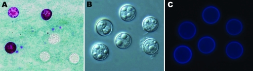a-c)Cyclospora cayetanensis oocysts under microscopy