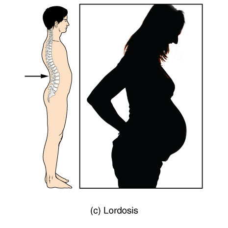 File:Bones and ligaments of the vertebral column (illustrations) (Radiopaedia 42770-45935 P 1).jpg