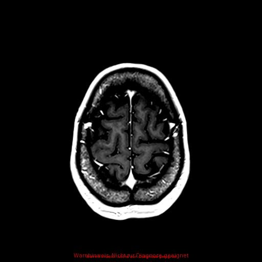 Normal adult brain MRI (non-enhanced and contrast-enhanced) (Radiopaedia 75262-86379 Axial T1 C+ 158).jpg