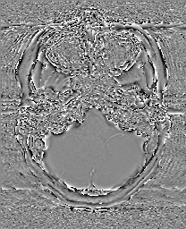 Cerebral cavernous venous malformation (Radiopaedia 70008-80021 G 13).jpg