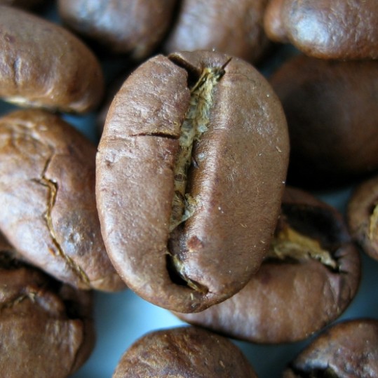 File:Coffee bean (photo) (Radiopaedia 36301).jpg