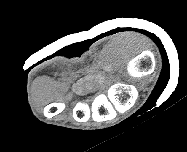 Normal wrist CT (Radiopaedia 41425-44297 Axial non-contrast 20).png