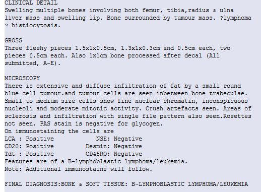 File:Acute lymphoblastic leukemia (Radiopaedia 40019-42548 A 1).JPG