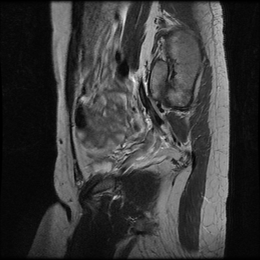 File:Normal female pelvis MRI (retroverted uterus) (Radiopaedia 61832-69933 Sagittal T2 8).jpg