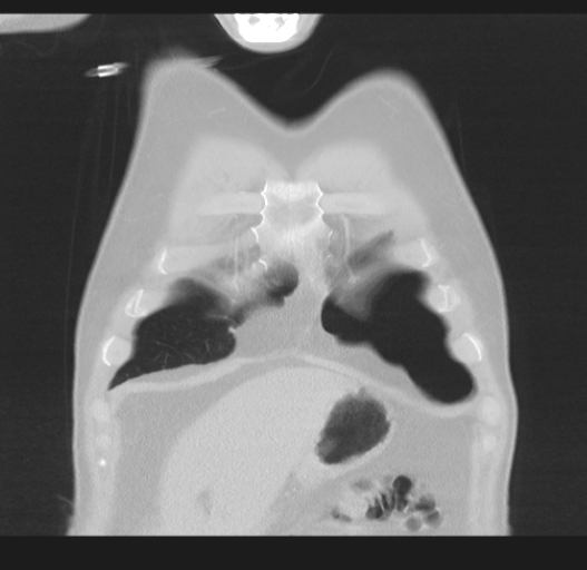 Cavitating pneumonia complicated by pneumothorax (Radiopaedia 48149-52994 Coronal lung window 9).png